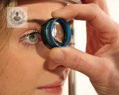 glaucoma-congenito