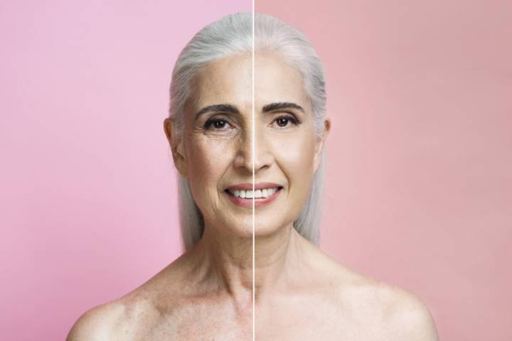 conoce-todos-beneficios-lifting-facial imagen de artículo