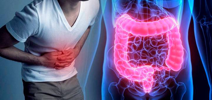 impacto-de-las-enfermedades-inflamatorias-intestinales-en-la-calidad-de-vida imagen de artículo