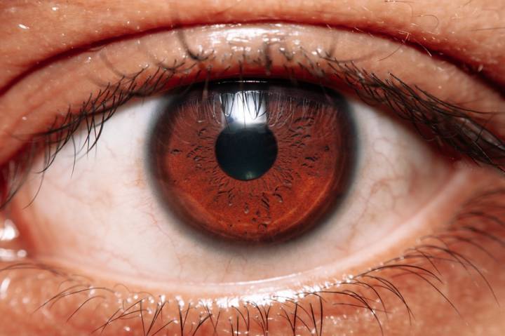 retina-que-enfermedades-se-manifiestan imagen de artículo