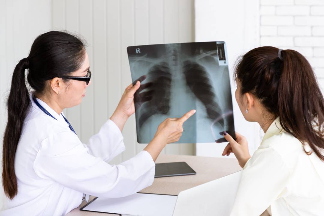 cancer-pulmon-curable-mortal imagen de artículo
