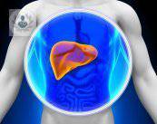 Hepatitis crónica, inflamación persistente del hígado