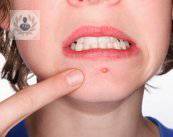 pubertad-y-adolescencia