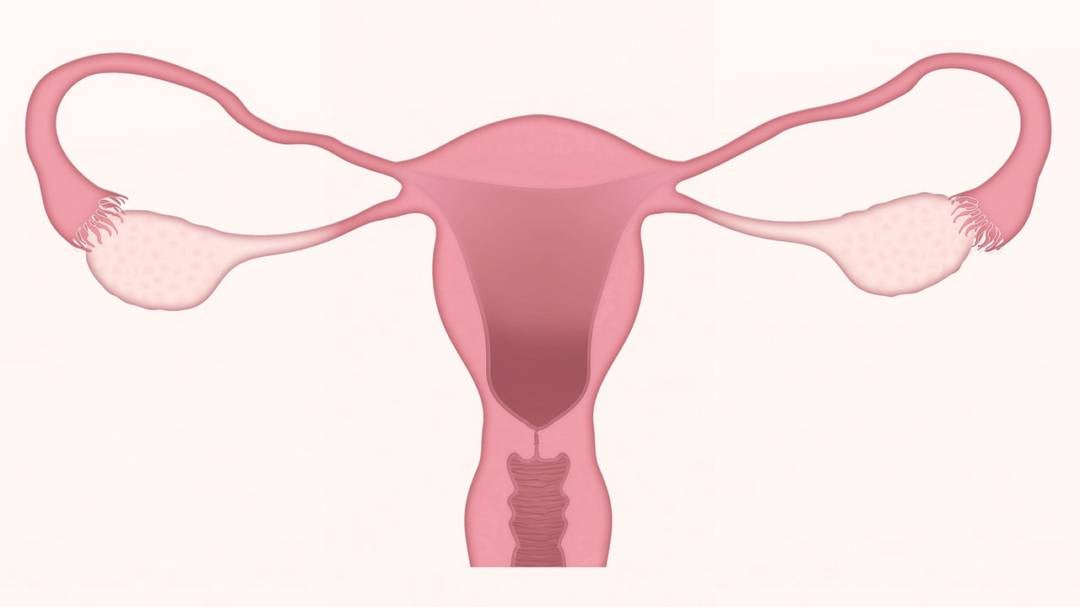 Ovario Poliquístico, tratamiento y causas 