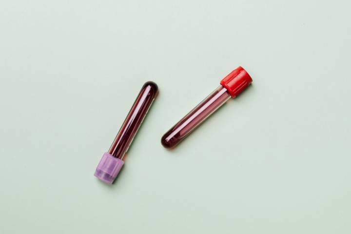 que-es-la-hemofilia-y-como-debe-tratarse imagen de artículo