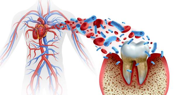 enfermedades-periodontales-y-enfermedades-sistemicas imagen de artículo