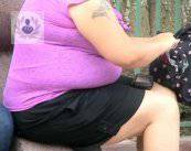 apnea-obstructiva-del-sueno