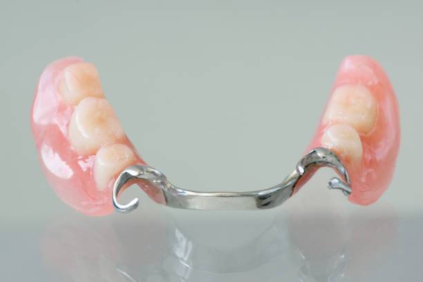 cuidados-para-protesis-dental-la-clave-para-una-sonrisa-duradera imagen de artículo