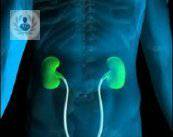 ¿Litiasis renal o piedras en el riñón? Conoce más (P2)