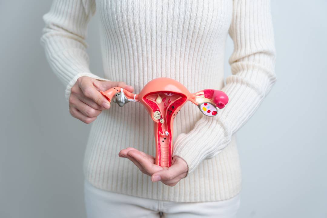 Miomas Uterinos: Tratamiento sin cirugía mediante Embolización