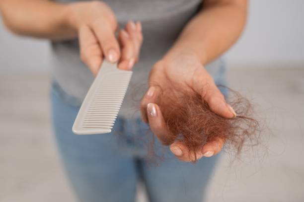 por-que-perdemos-cabello-explorando-las-causas-de-la-alopecia imagen de artículo