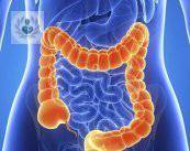 Cáncer de colon, apéndice y recto, prevención y tratamiento
