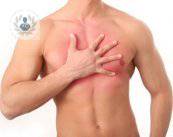 Ginecomastia, procedimiento de reducción mamaria en hombres