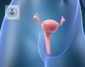 Histerectomía, operación para tratar problemas uterinos