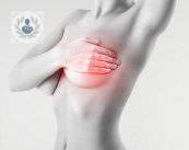 bolitas-en-los-senos