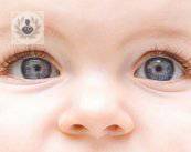 Cáncer de ojo en niños: cómo identificarlo (P2)