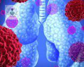 diagnostico-de-cancer