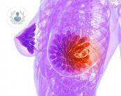 Mastografía: estudio ideal para detectar enfermedades mamarias (P2)