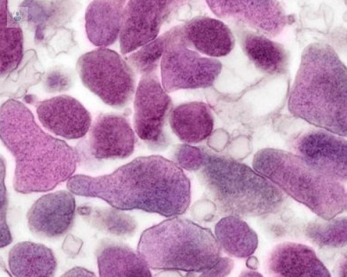 Micoplasma Genital: la superbacteria que amenaza la salud sexual
