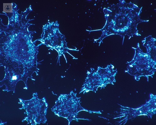 celulas-tumorales-cancer