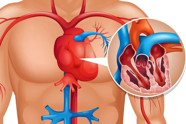Principales síntomas que se manifiestan antes de sufrir un infarto