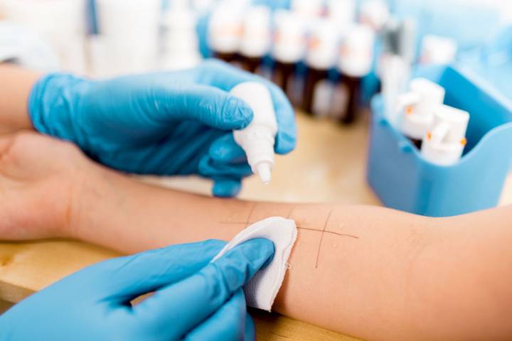 la-inmunoterapia-como-tratamiento-para-las-alergias imagen de artículo