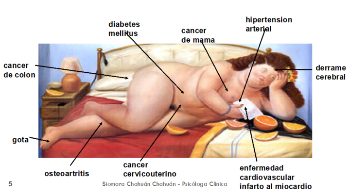 en-que-consiste-la-psicologia-bariatrica imagen de artículo