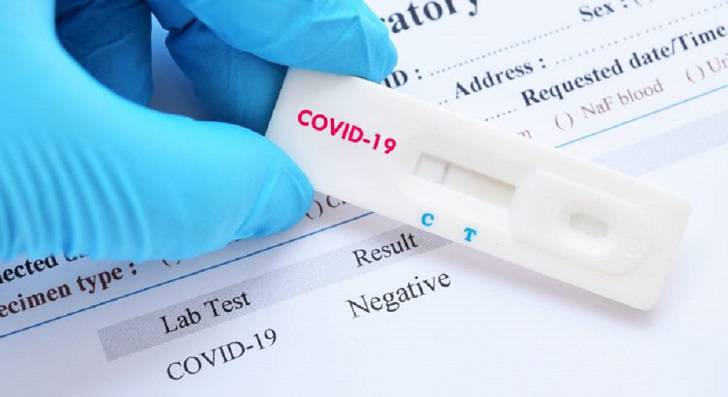 Resultados positivos en prueba contra el Coronavirus