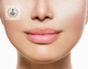 Aumento de labios, procedimiento efectivo y duradero