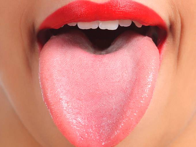 lengua-geografica-afeccion-que-afecta-mas-a-la-poblacion-femenina imagen de artículo