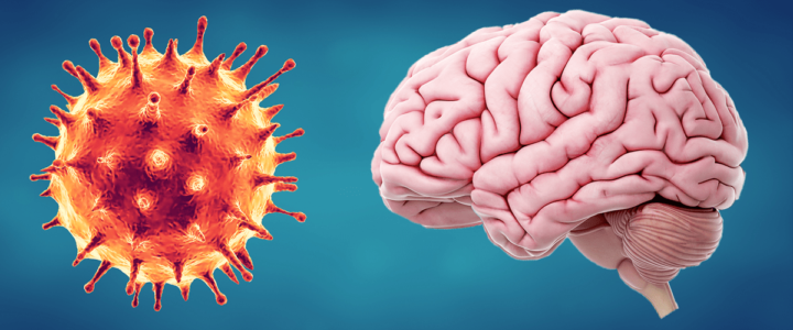 covid-19-provoca-inflamacion-cerebral-similar-similar-al-alzheimer-o-al-parkinson imagen de artículo