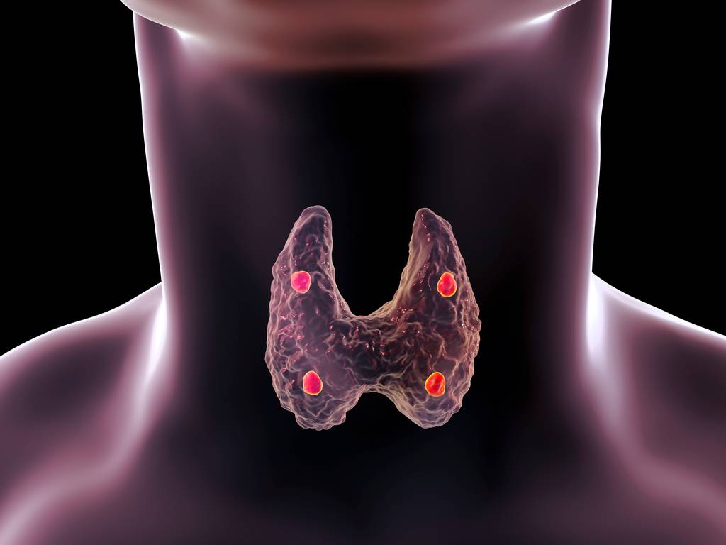cancer-de-tiroides-causas-sintomas-y-tratamiento imagen de artículo