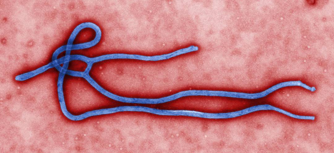 Este mecanismo podría ser la clave para prevenir el Ébola