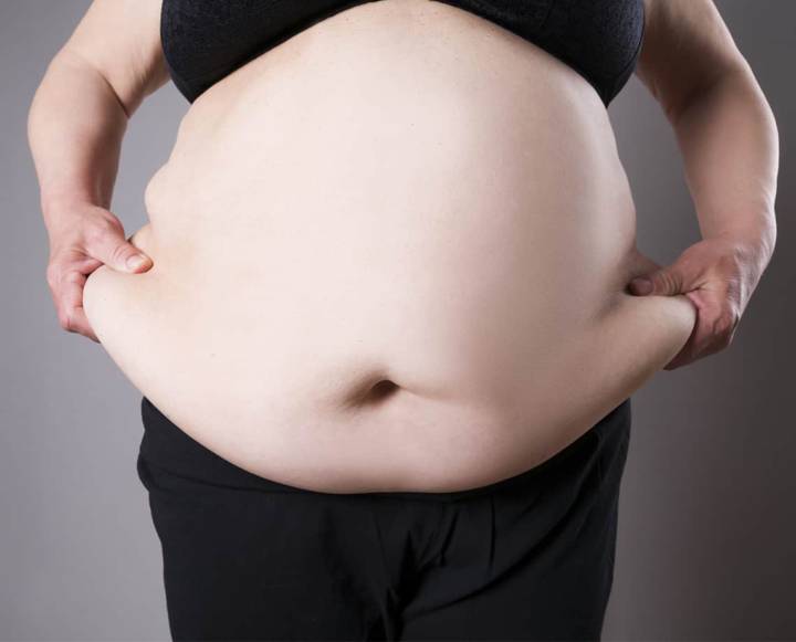 cirugia-de-la-obesidad imagen de artículo