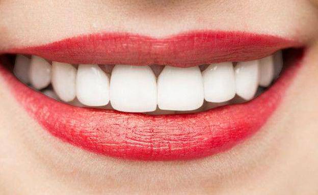 por-que-es-bueno-enderezarse-los-dientes imagen de artículo