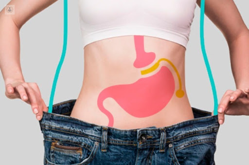 lo-que-debes-de-saber-de-la-cirugia-bariatrica imagen de artículo