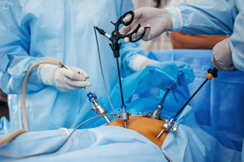 Cirugía Laparoscópica 3D