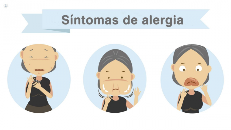 Alergia Alimentaria