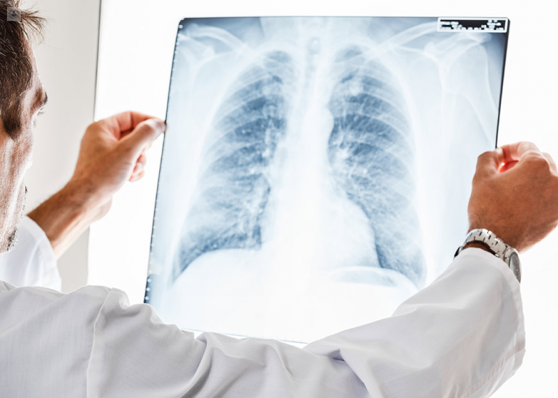 Diagnóstico del Nódulo Pulmonar