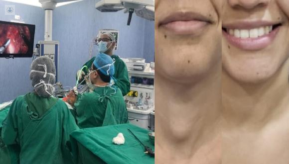 Cirugía de la tiroides 