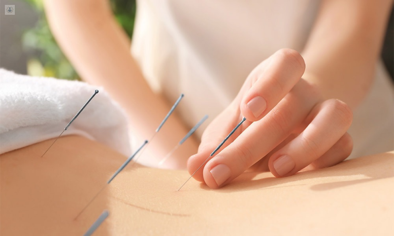 Cuáles son los puntos de la acupuntura?