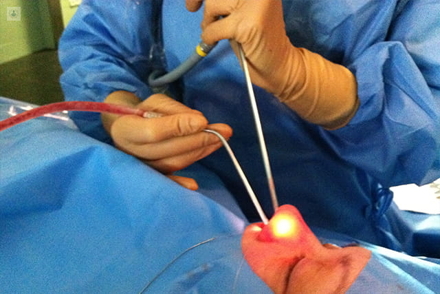 Cirugía endoscópica nasosinusal