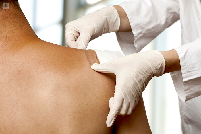 Microcirugía de Mohs