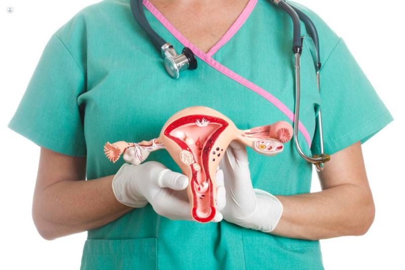 conizacion biopsia de cuello uterino
