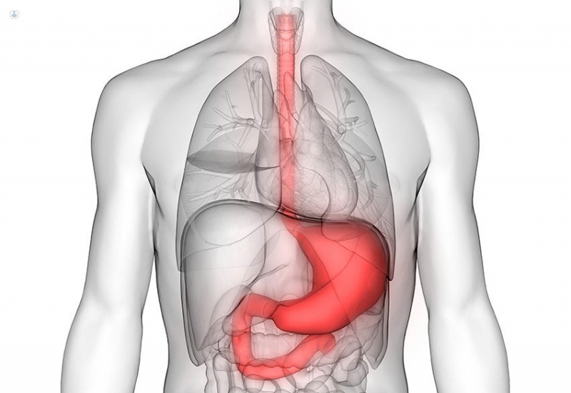 Aneurisma de Aorta