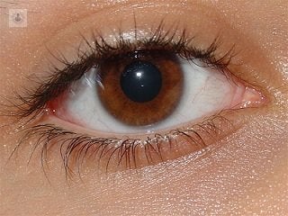 Cirugia refractiva con laser sirve para corregir los defectos de refraccion en los ojos