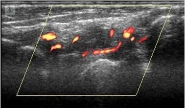 ecografia musculoesqueletica