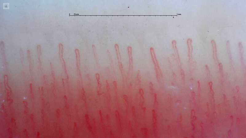 https://es.capillary.io/capilaroscopios/smart-g-scope/