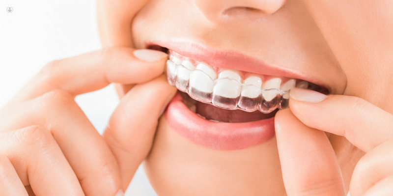 C Mo Es La T Cnica Del Invisalign Top Doctors