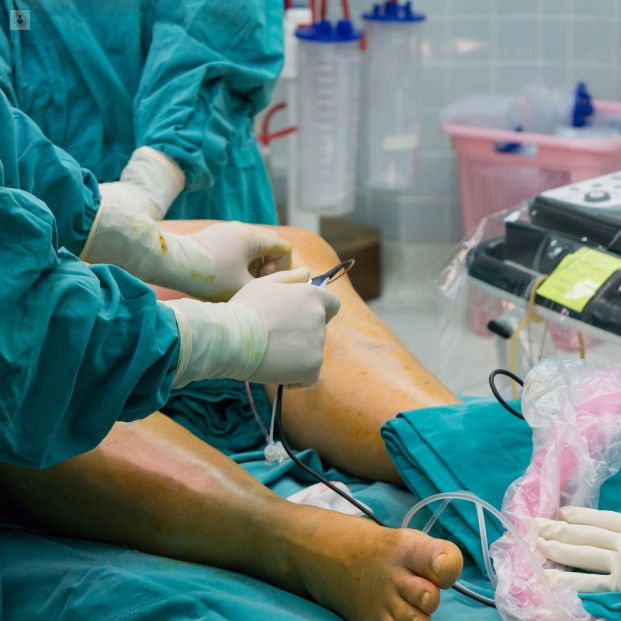 Angioplastia Transluminal Percutánea